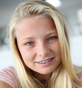 Teen girl with braces