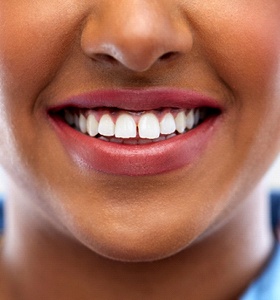 A woman with a small gap between her teeth