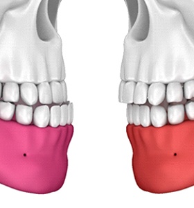 jaw alignment illustration