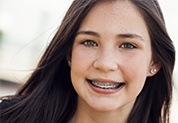 Teen girl with braces