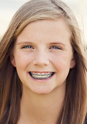 One of our patients with braces