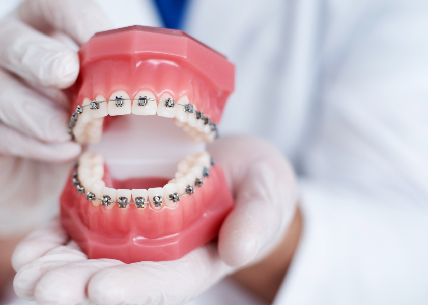 Dentures